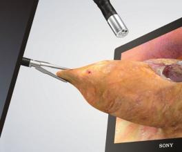 3D腹腔镜手术